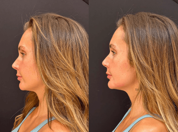 Allure Aesthetics photo 3