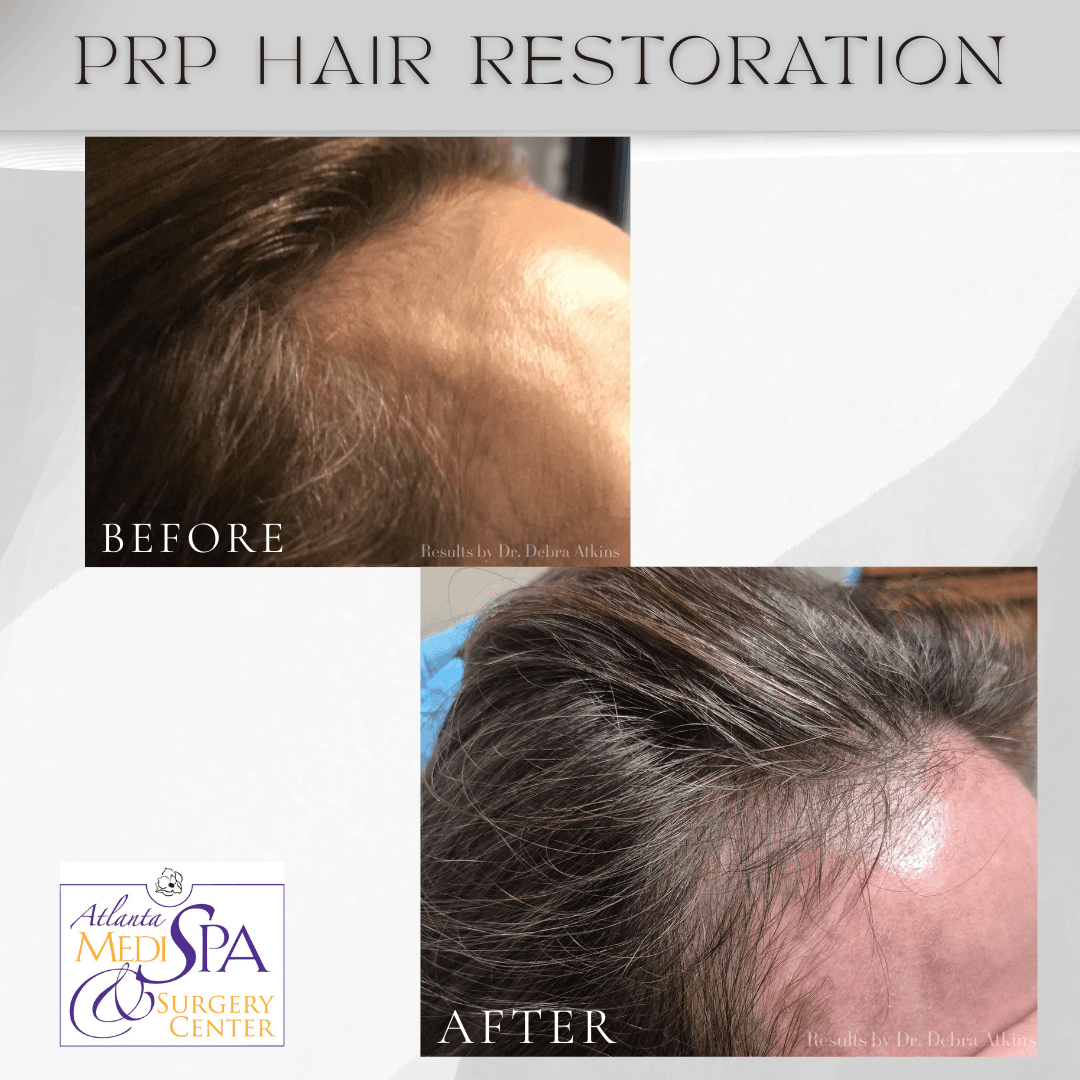 Atlanta MediSpa & Surgery Center photo 3