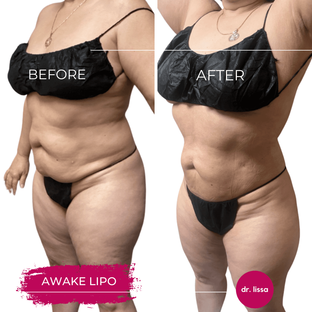 Body Esthetics: Dr. Lissa Plastic Surgery photo 2