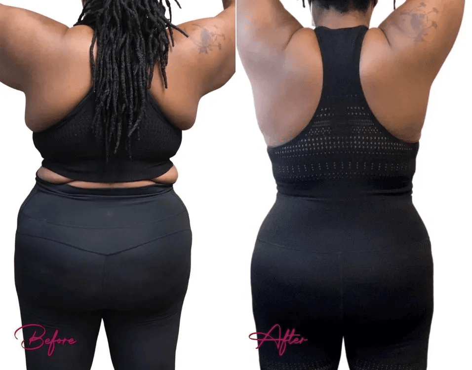 Body Esthetics: Dr. Lissa Plastic Surgery photo 3