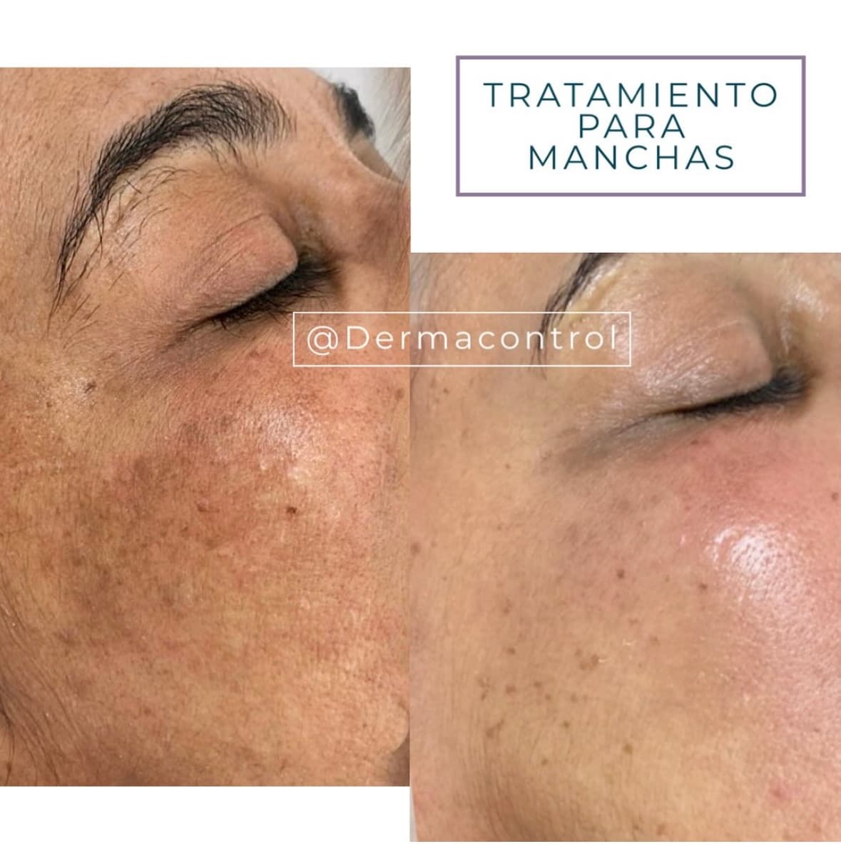DERMACONTROL photo 3