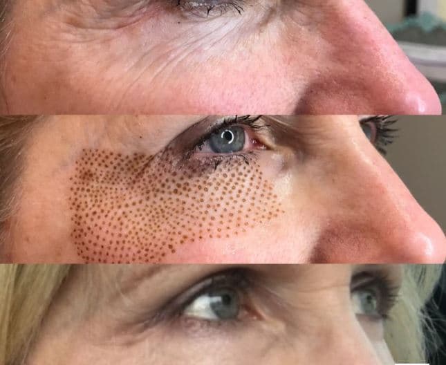 ELLEMES Medical Spa photo 2