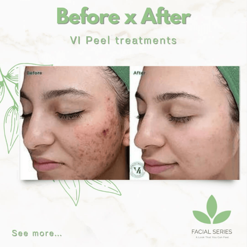 Facial Series Med Spa photo 2