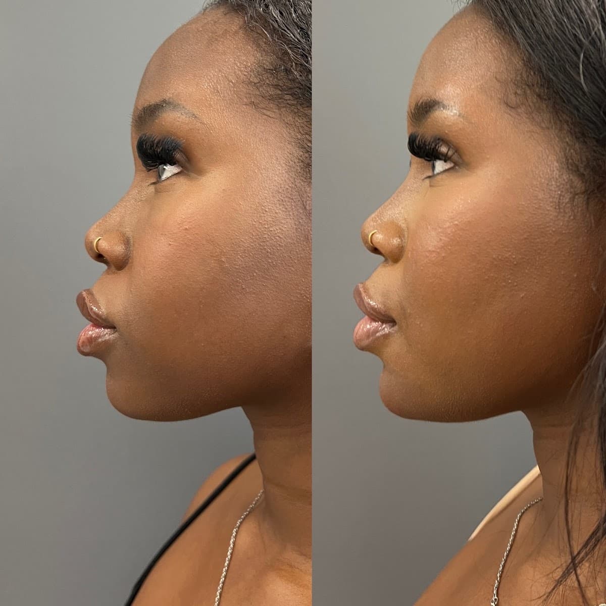 Glo & Glam Viridian - MedSpa & Skin Care photo 2