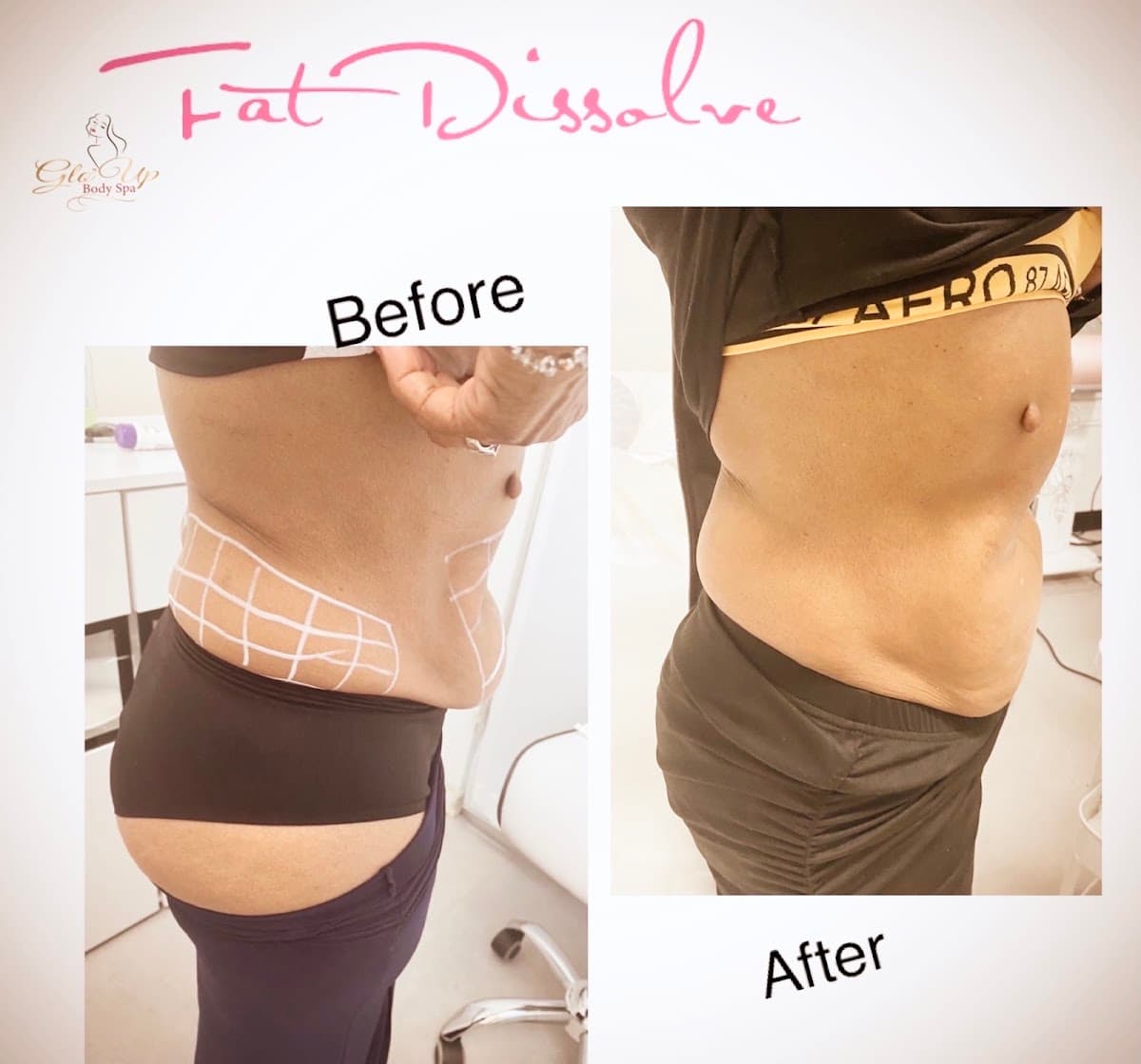 Glo'Up Body Spa photo 2