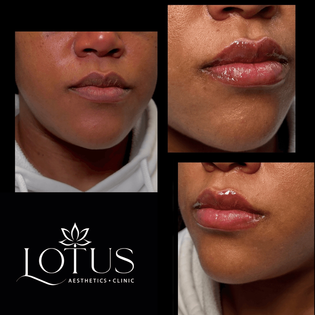 Lotus Aesthetics Clinic photo 3