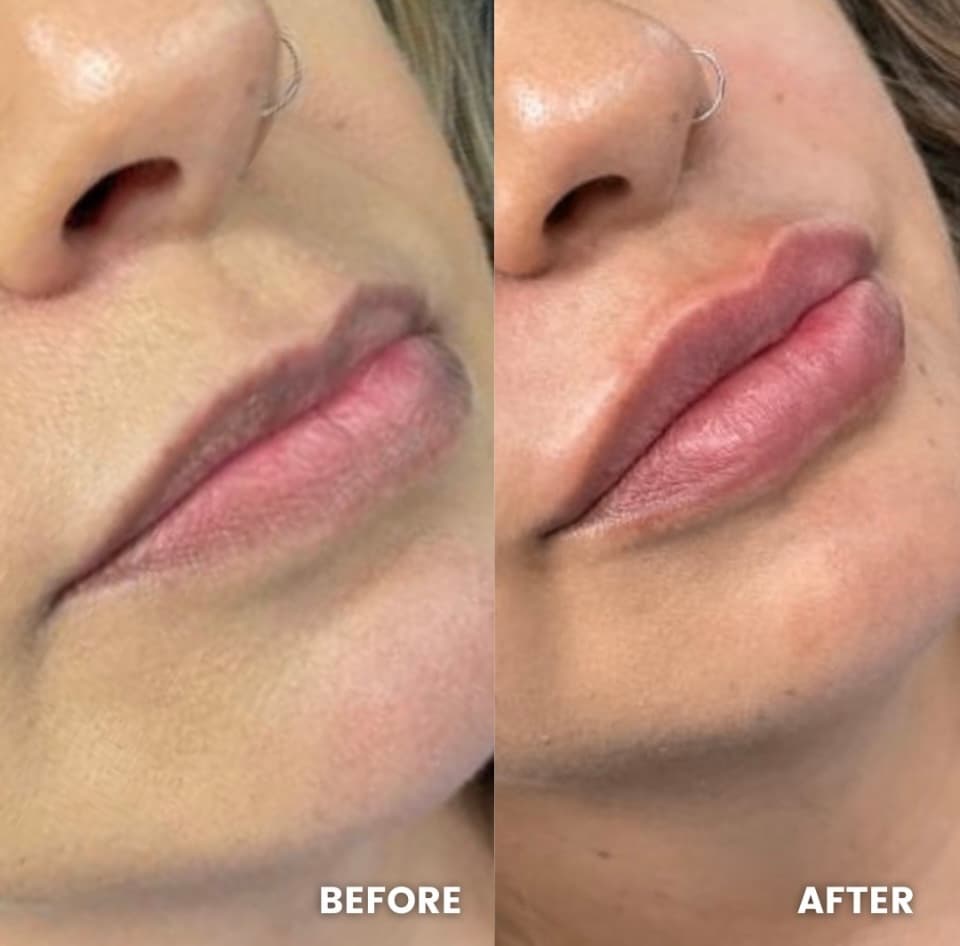 Medspa of Dallas photo 1