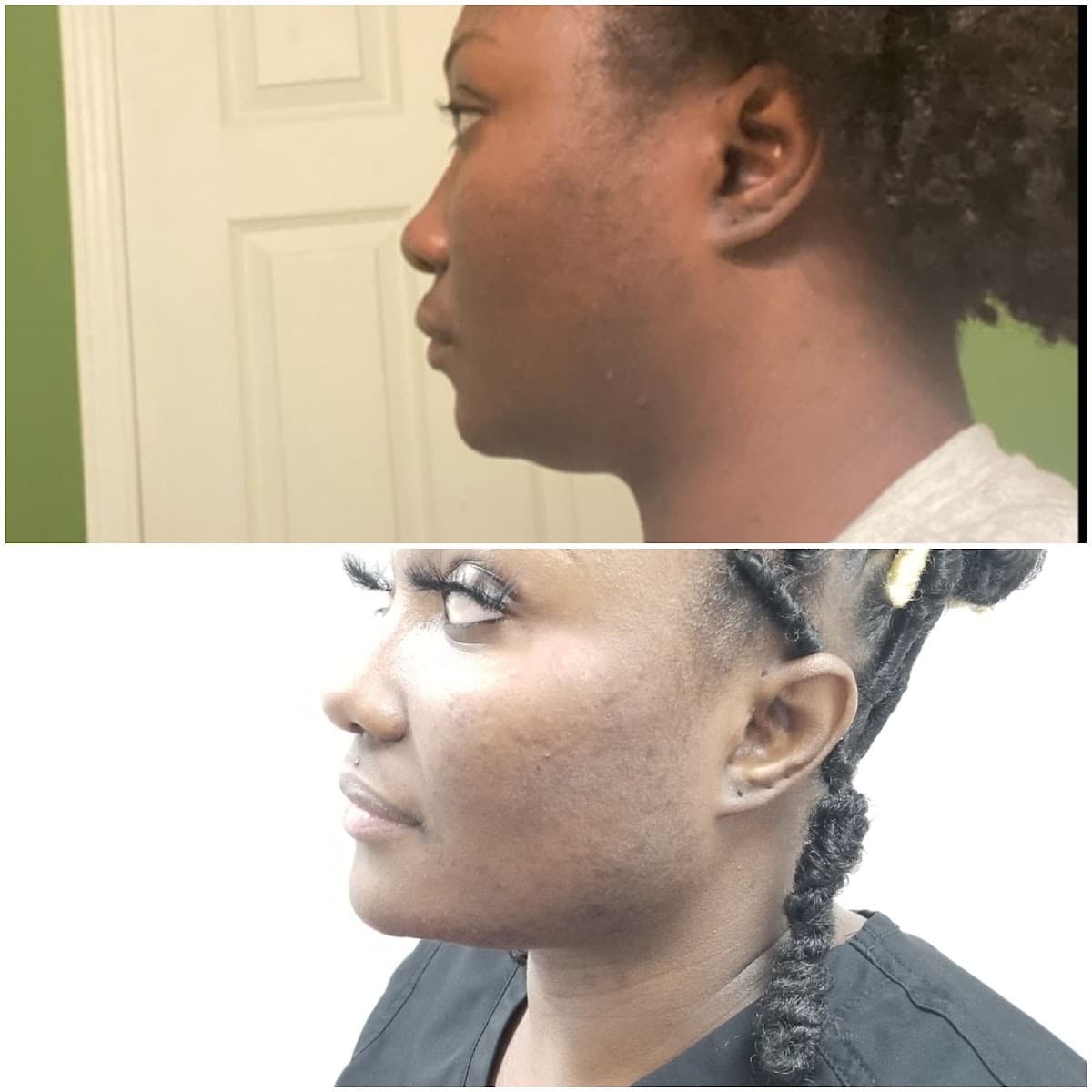 Natural Injections by Laura Medspa photo 3