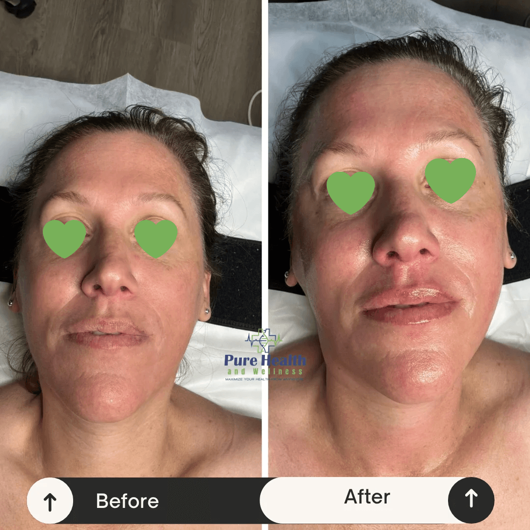 Pure Health and Wellness | IV Therapy, Weightloss & Facials photo 2