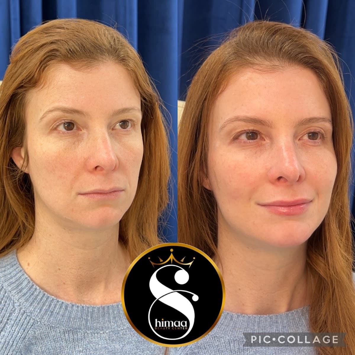Shimaa Beauty Center Arlington photo 1
