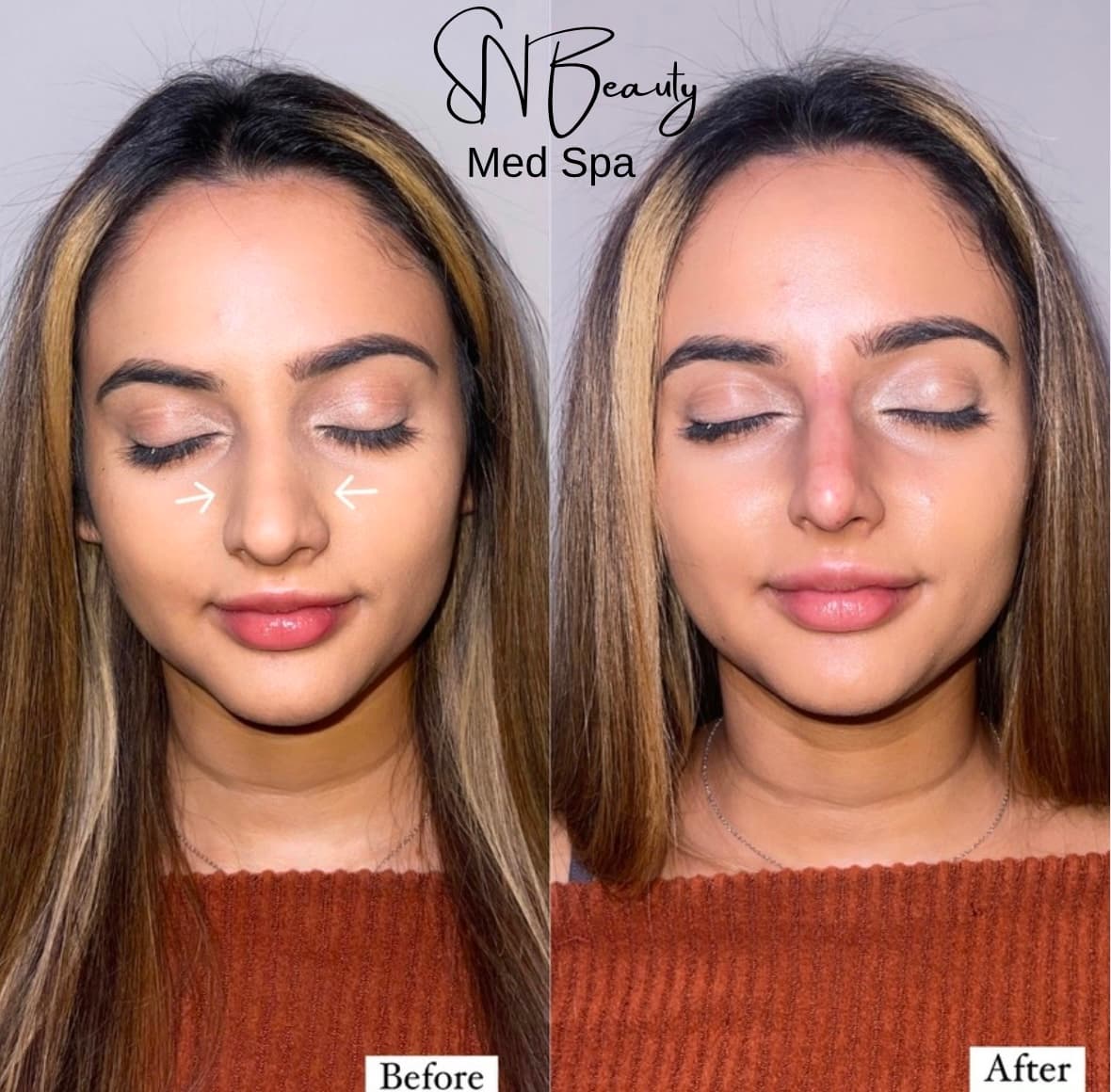 SN BEAUTY MEDICAL SPA photo 3