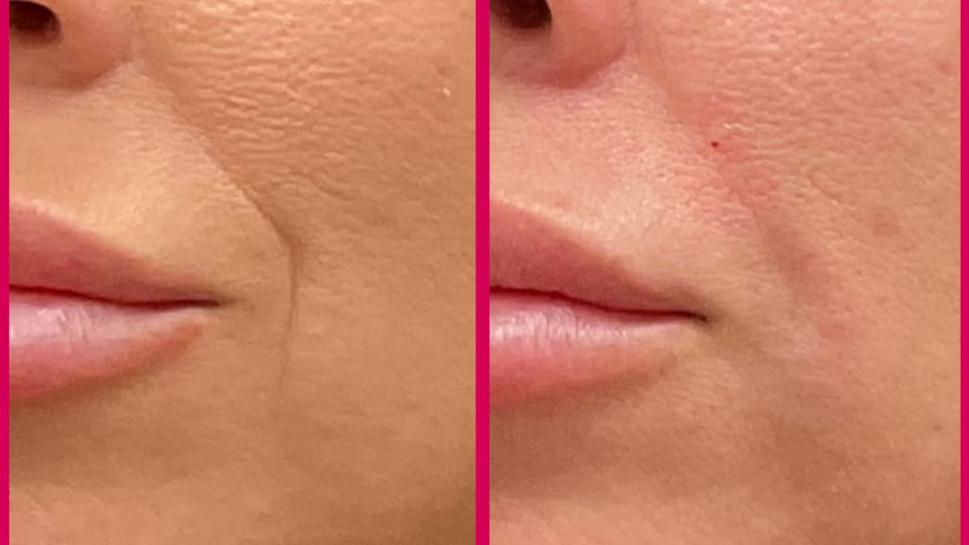 SUR MedSpa - Marietta, GA photo 1
