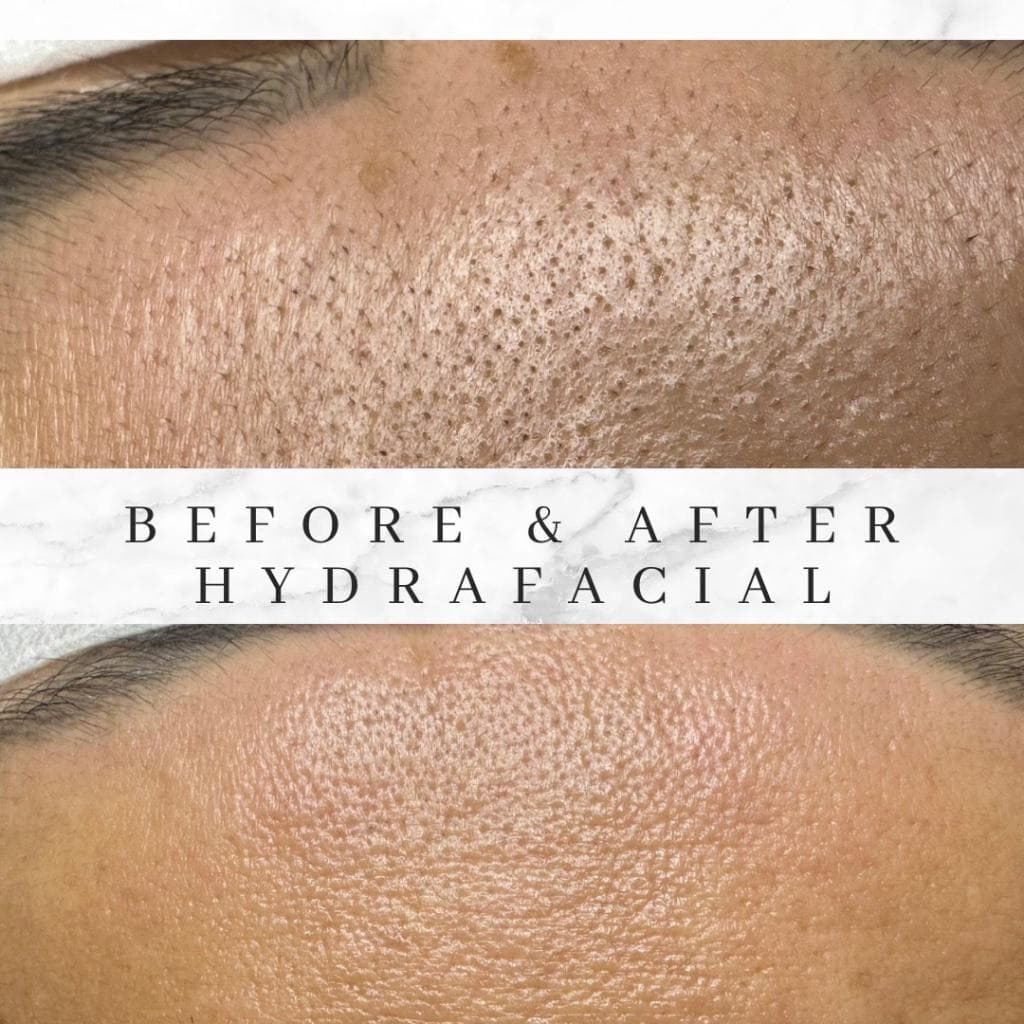 Synergy Holistic Esthetics (SHE SPA) photo 1
