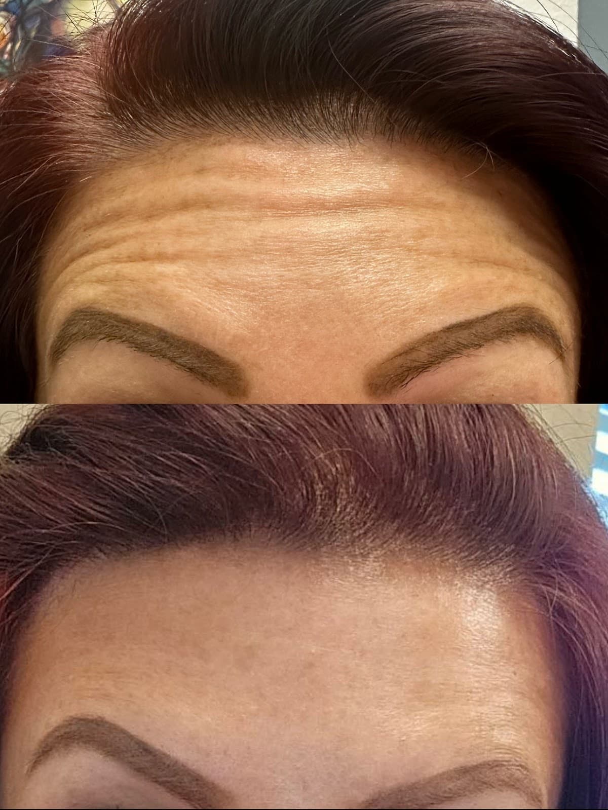 Texas Needle Queen • Botox & Lip Filler Clinic | Round Rock, TX photo 1