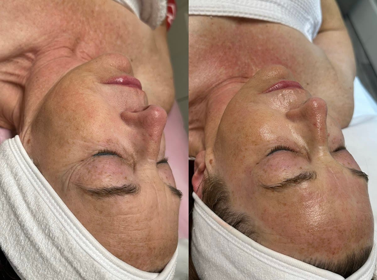 Texas Needle Queen • Botox & Lip Filler Clinic | Round Rock, TX photo 2